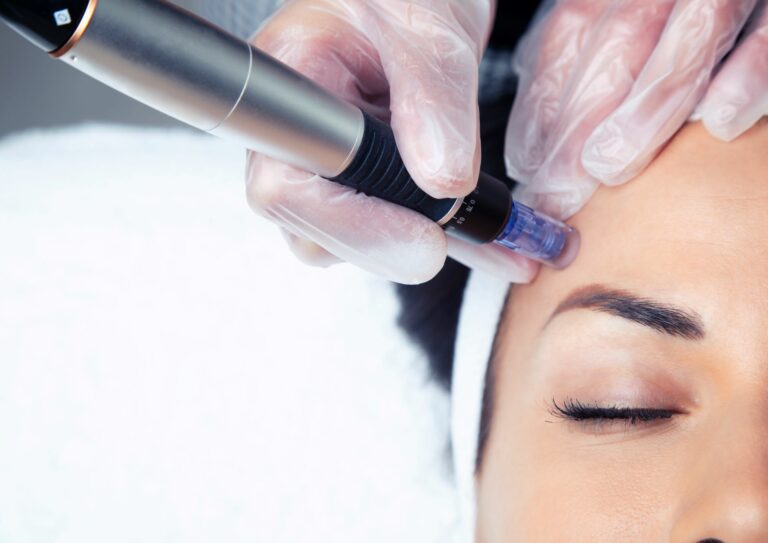 Mezoterapia mikroiglowa (dermapen)